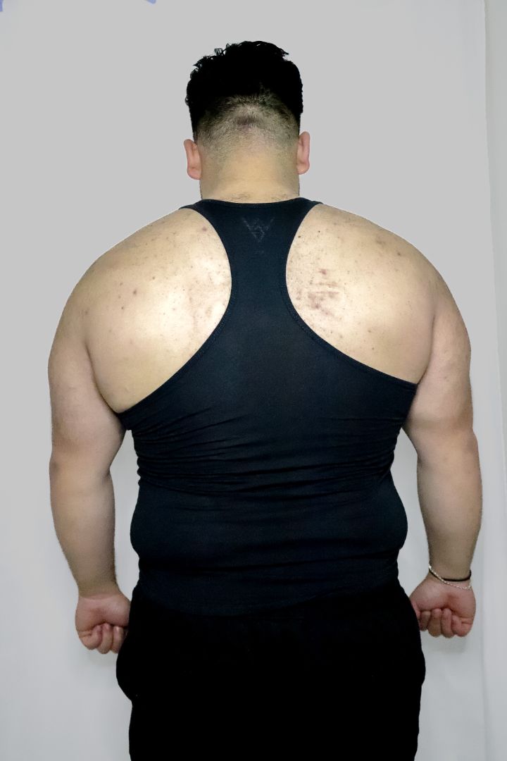 Staple Stringer/Tank